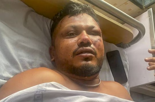 Phép màu giữa bi kịch: Người sống sót duy nhất chính thức trả lời phỏng vấn