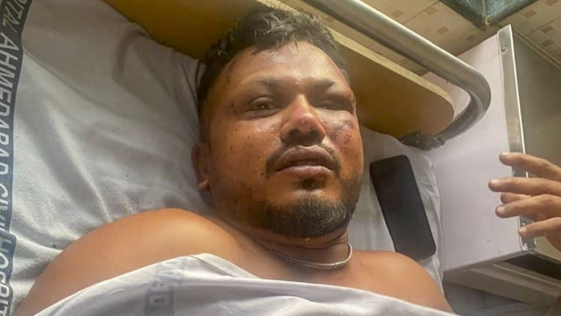 Phép màu giữa bi kịch: Người sống sót duy nhất chính thức trả lời phỏng vấn